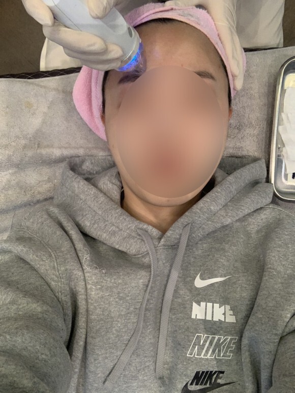 크라이오셀 후기