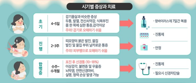 대상포진 빨리 낫는 법