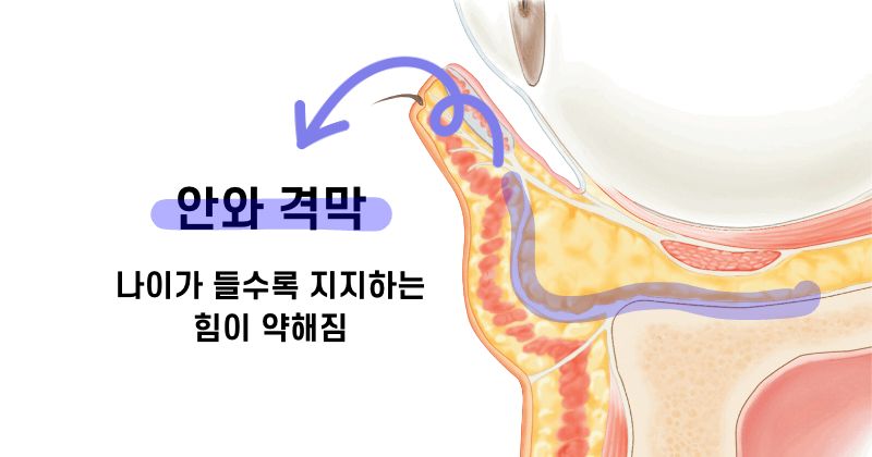 안와 격막