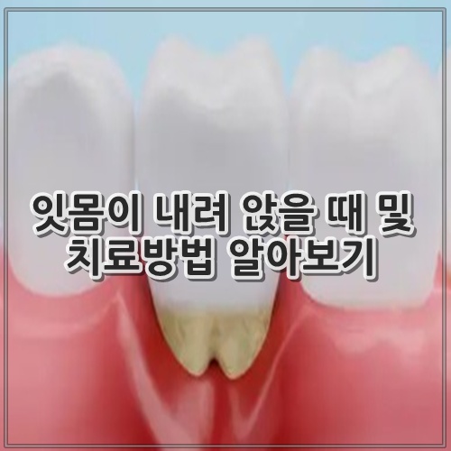 잇몸이 내려 앉을 때 및 치료방법 알아보기