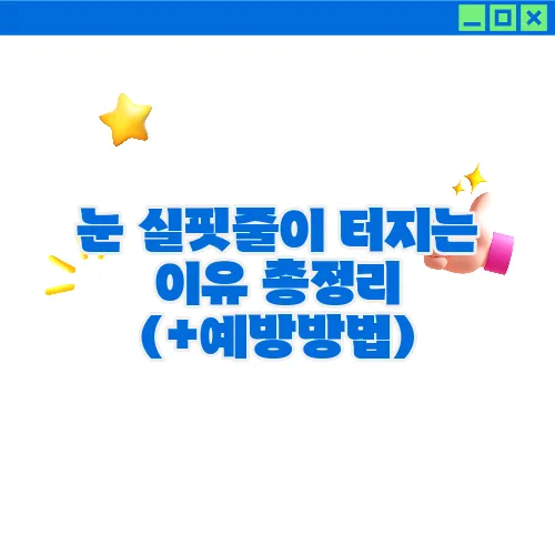 눈 실핏줄이 터지는 이유 총정리 (+예방방법)