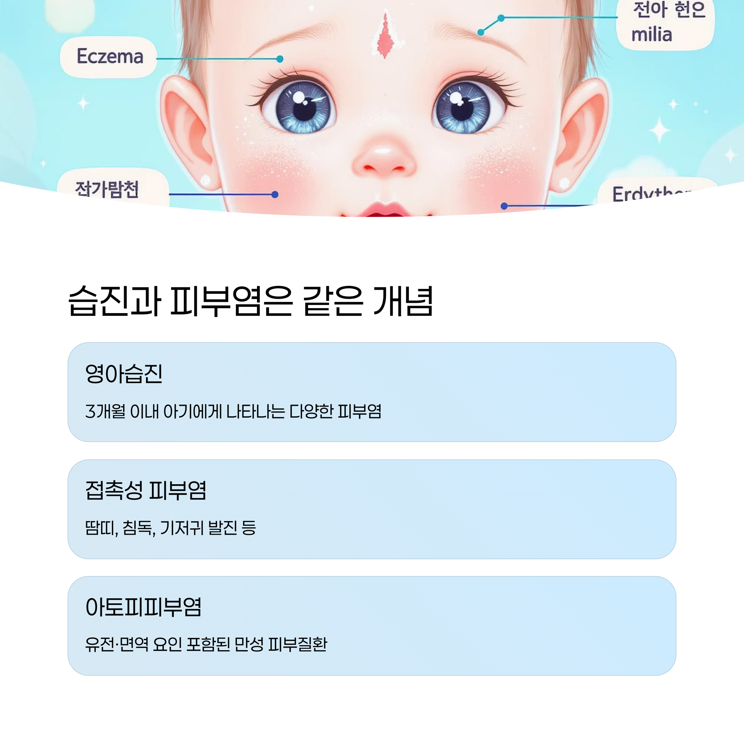 아기 얼굴 주변의 다양한 습진 유형을 시각적으로 설명하며 영아습진, 접촉성 피부염, 아토피피부염의 차이를 정리한 이미지