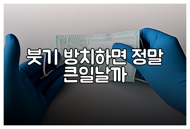붓기 방치하면 정말 큰일날까