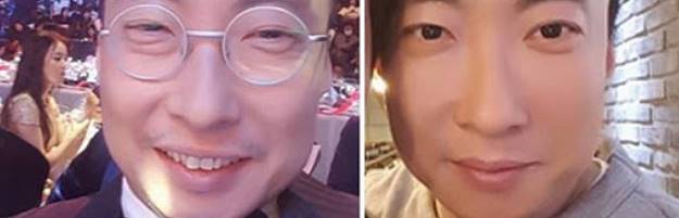 눈밑지방제거 수술비용