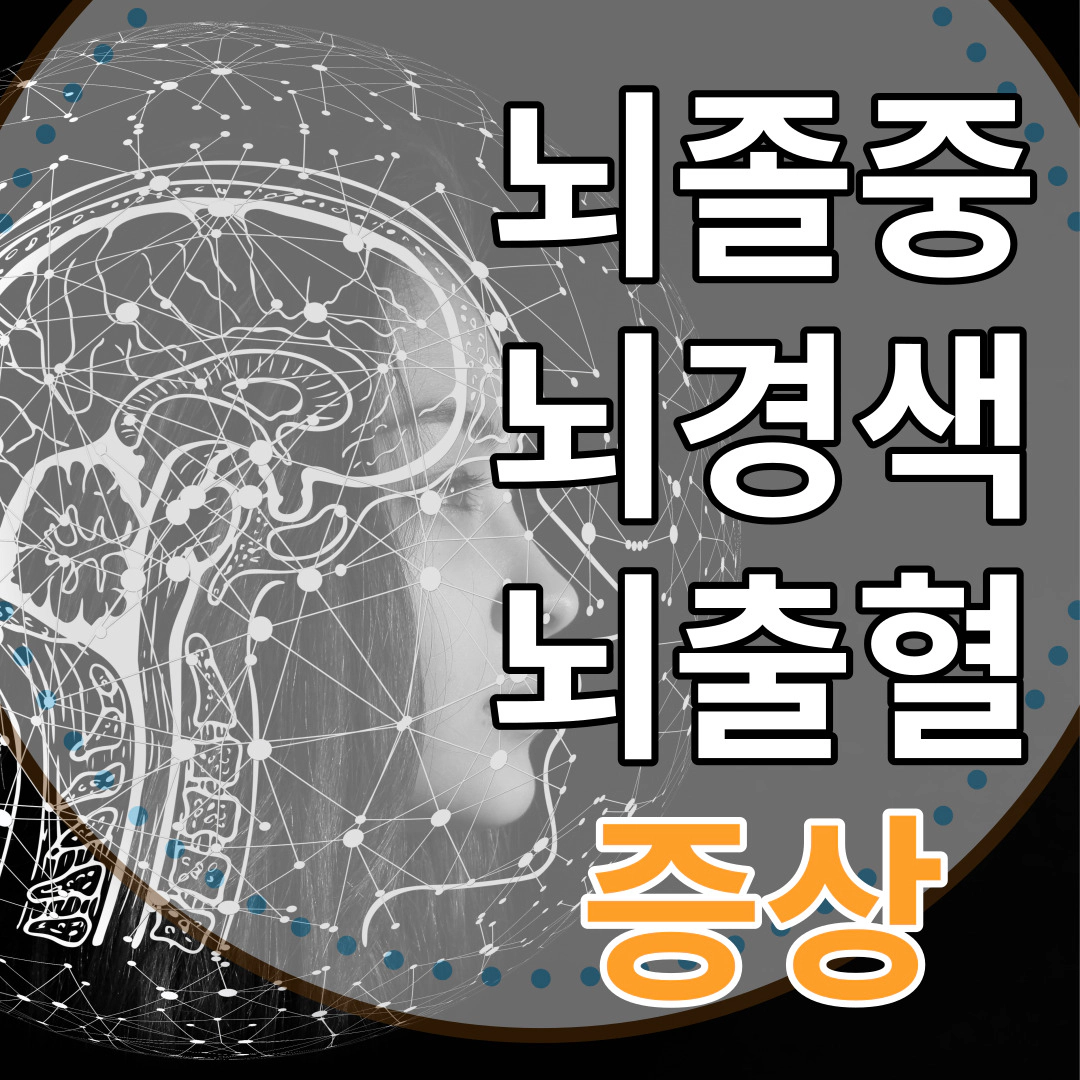 뇌경색 전조 증상-뇌졸중 초기 증상-뇌출혈 초기 증상