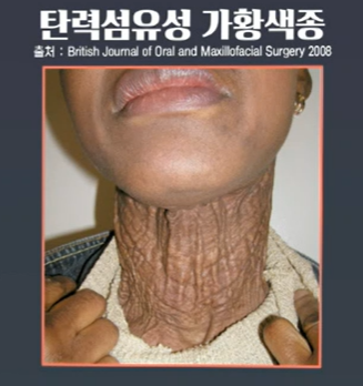 프로테오글리칸