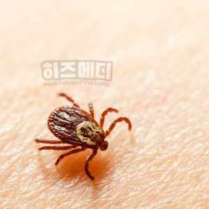 쯔쯔가무시 증상