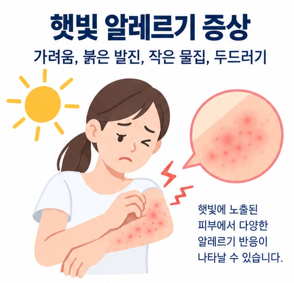 햇빛 알레르기 증상과 가려움 붉은 발진 작은 물집 두드러기를 보여주는 피부 건강 교육 이미지