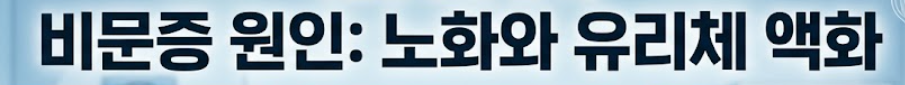 비문증 원인