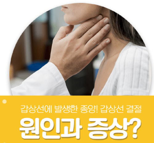 갑상선 결절