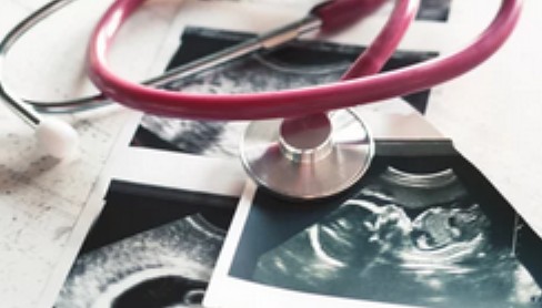 임신 초기증상12