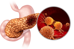 췌장암에 좋은 음식04