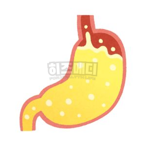 위내시경 전날 음식 금식시간