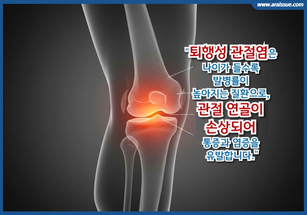 퇴행성 관절염은 나이가 들수록 발병률이 높아지는 질환으로, 관절 연골이 손상되어 통증과 염증을 유발합니다.