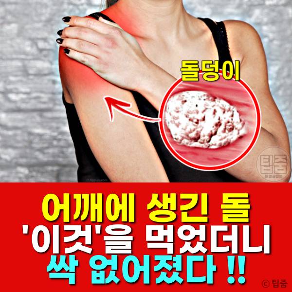 석회성건염에 좋은음식,석회화건염 좋은음식,팁줌