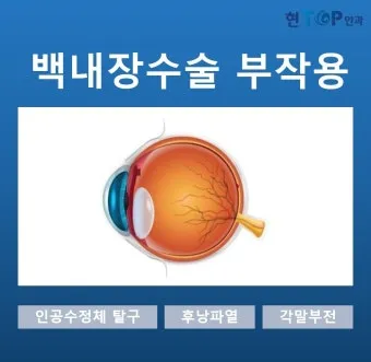 백내장 수술 비용 실비 보험 청구 회복기간_13