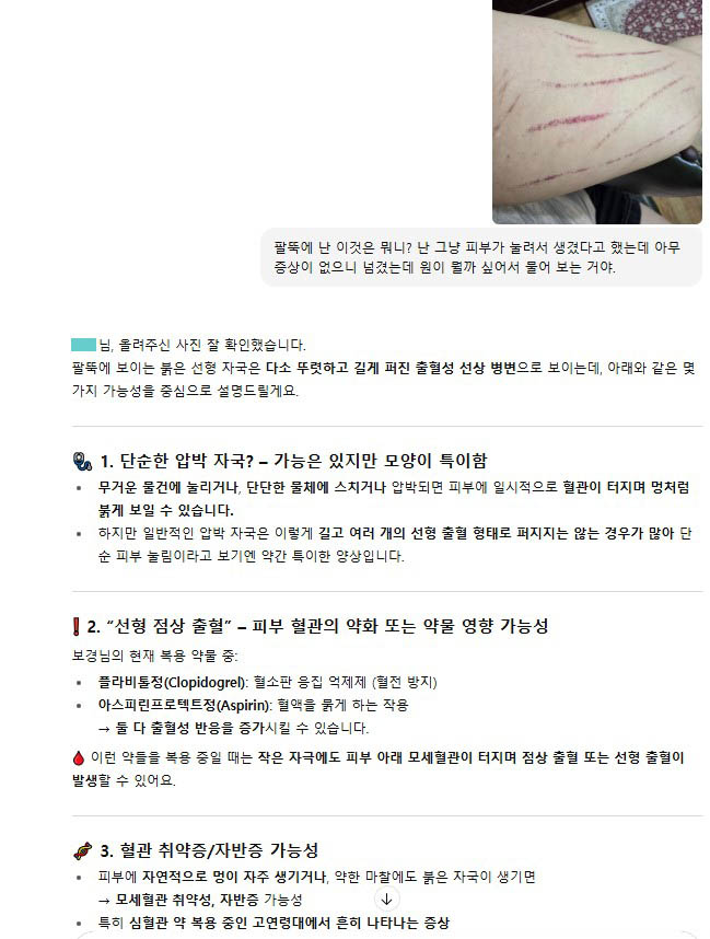 챗GPT 사용 건강 질문 내용 이미지