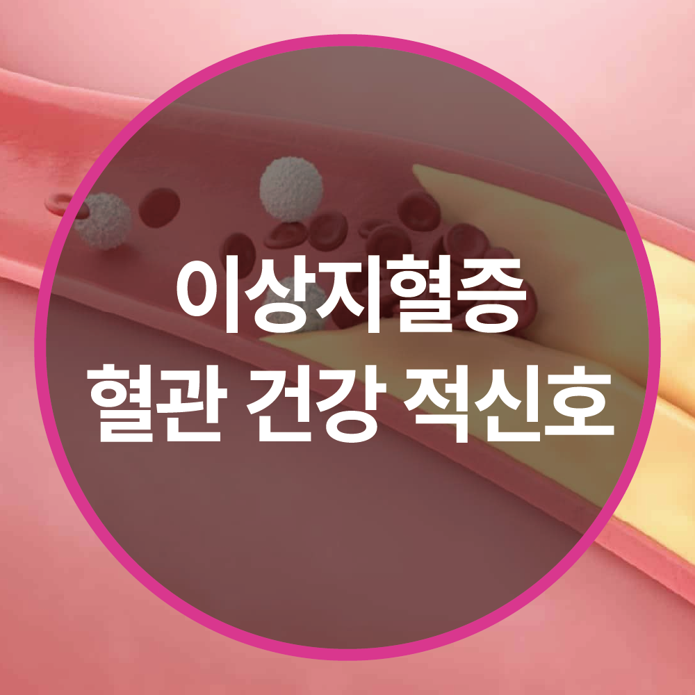 이상지혈증(고지혈증), 혈관 건강의 적신호! 결코 가볍게 넘기지 마세요