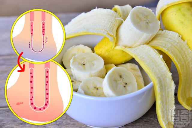 손발 차가움 수족냉증에 좋은 음식 바나나