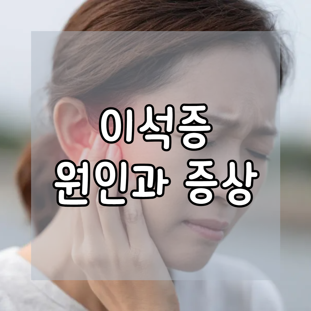 이석증과 스트레스의 관계