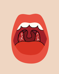 목에 이물감 느껴지는 증상