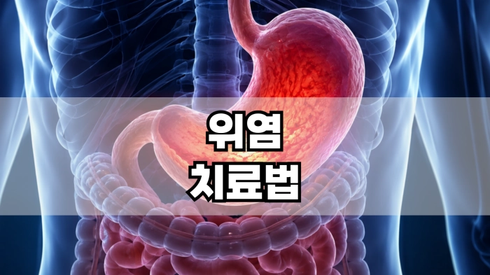 위염 치료법