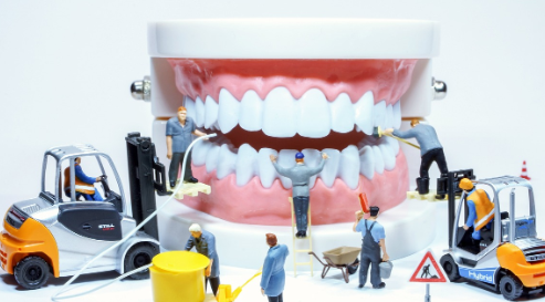 포항 임플란트 가격 싼곳 TOP3