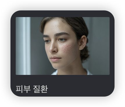 장누수-증후군-자기진단-여드름있는-얼굴