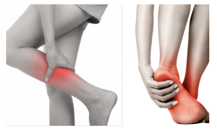 종아리 통증 진단