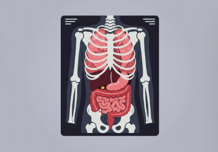 만성B형간염환자의 간암정기검진