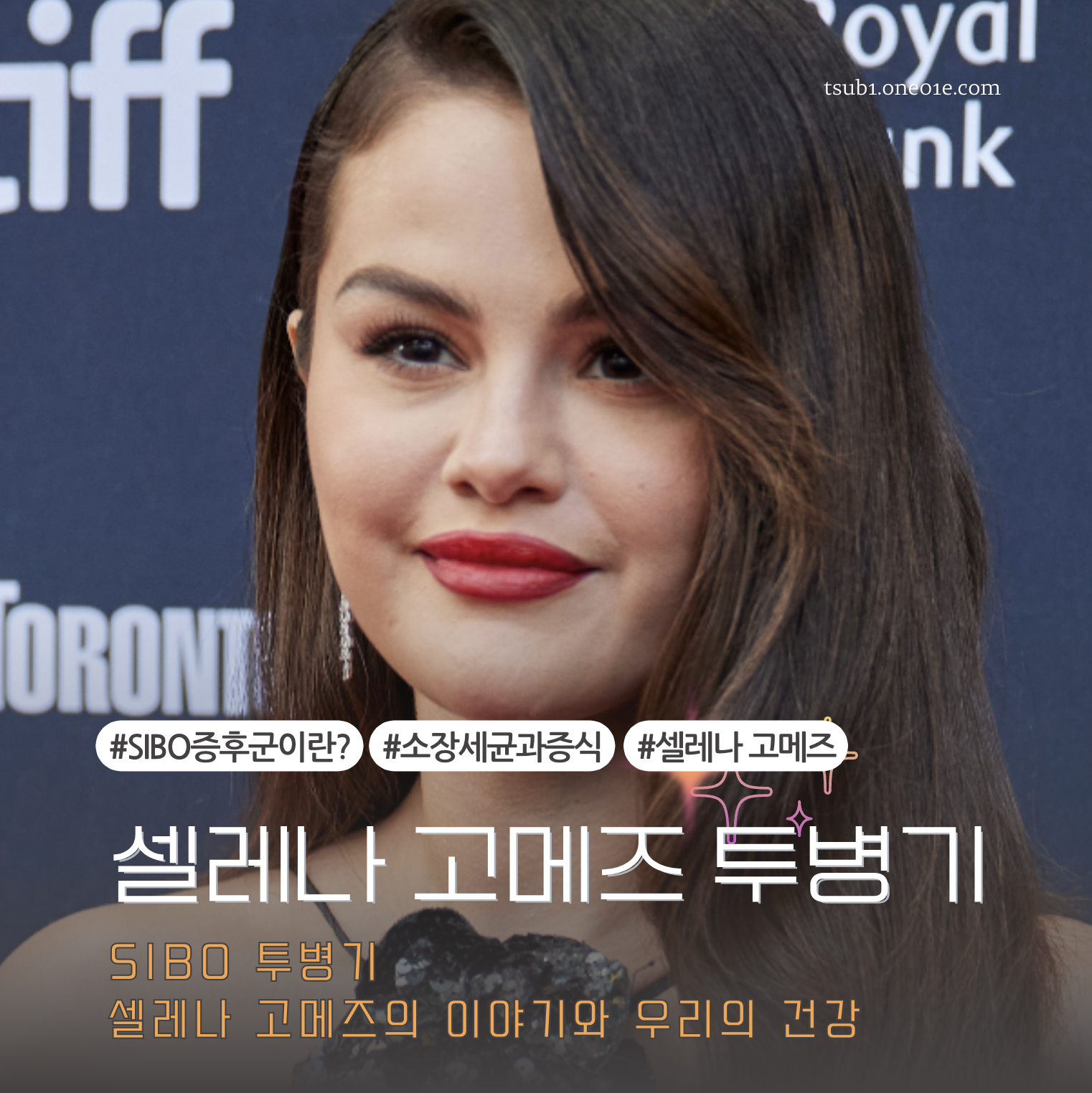 셀레나 고메즈의 SIBO 투병기