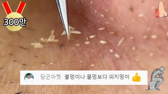 남자 얼굴 피지 제거 화장품 꿀템_6