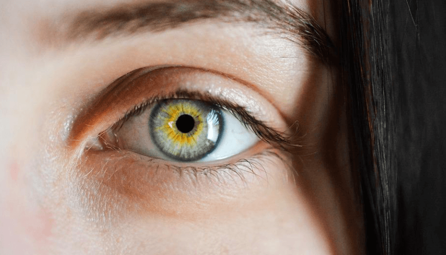 다크서클 생기는 이유03