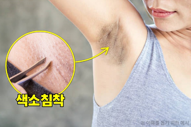 겨드랑이 제모, 모낭염, 겨드랑이 색소침착 원인, 건강 팁줌 매일꿀정보