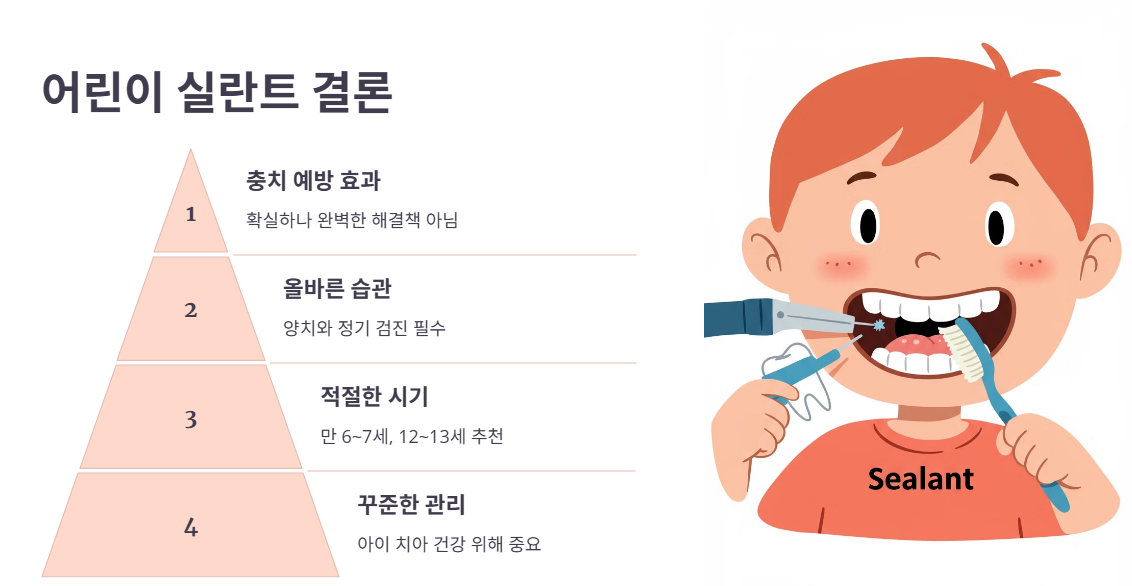 어린이 실란트 결론