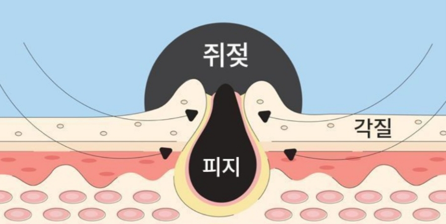 쥐젖