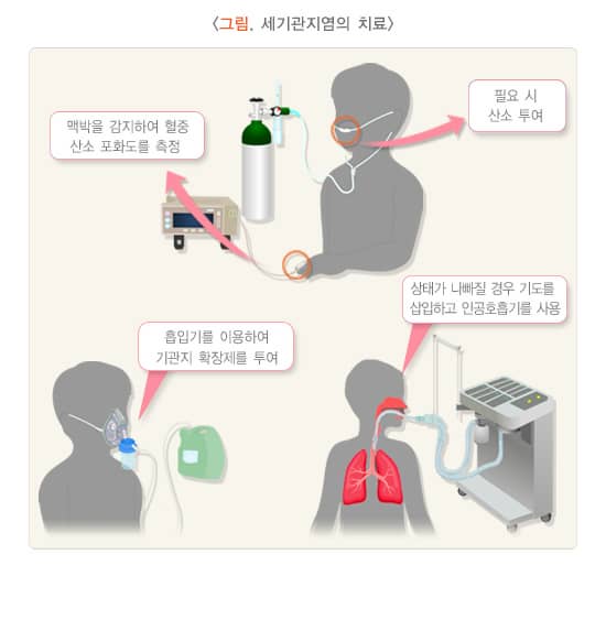 세관지염의치료