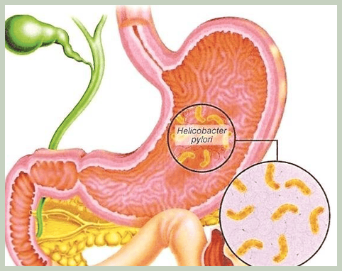 장상피화생에 좋은 음식