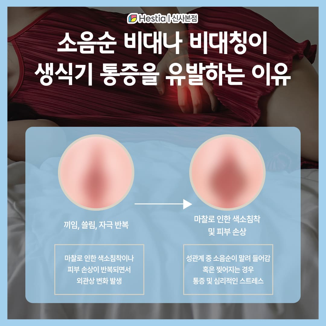 소음순 비대나 비대칭이 생식기 통증을 유발하는 이유