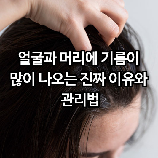 얼굴과 머리에 기름이 많이 나오는 진짜 이유와 관리법