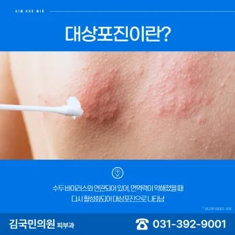 경기도 대상포진 무료접종 연령 기준 정리로 안내_20