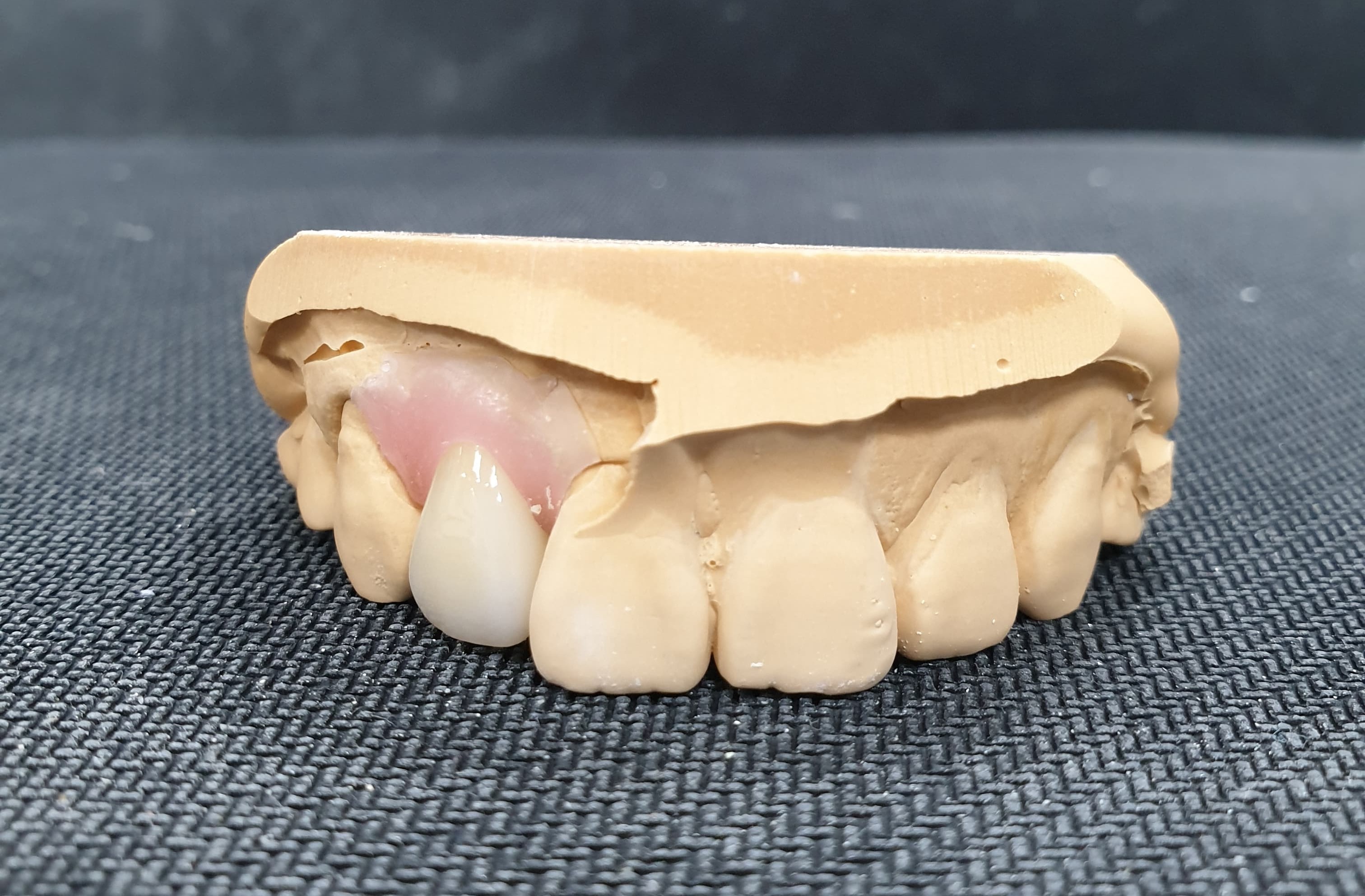 치과 기공사에 관하여..