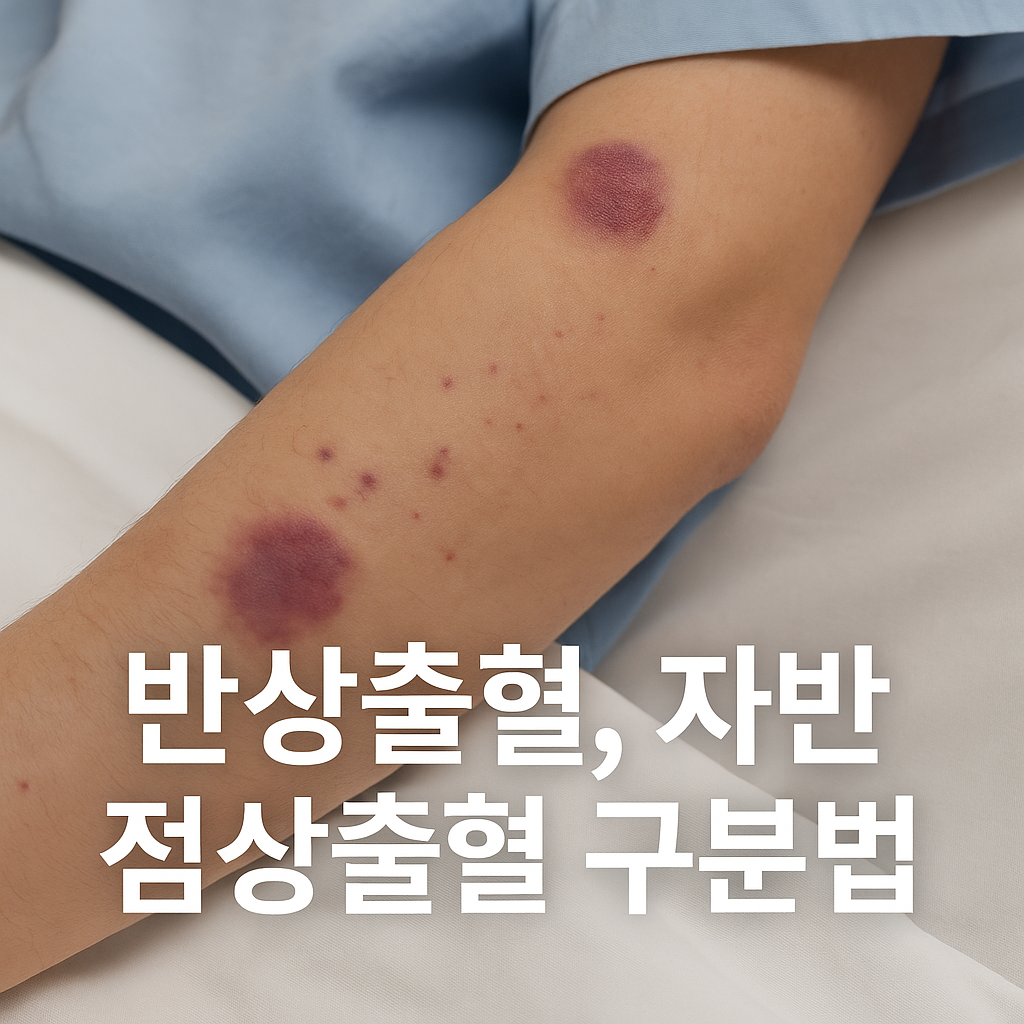 반상출혈, 점상출혈 구분법