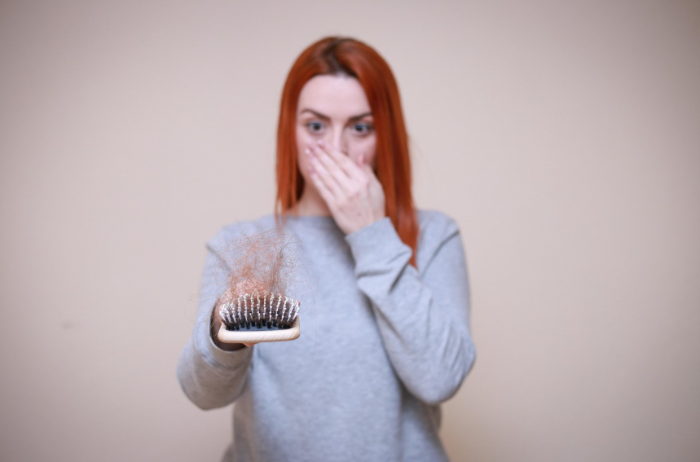 여성 탈모 증상으로 빠진 머리카락이 엉켜 있는 헤어브러시를 들고 놀란 표정을 짓는 여성 모습