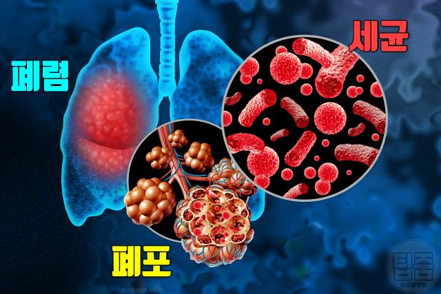 폐렴 증상 폐렴과 독감 차이 구준엽 부인 사망 원인