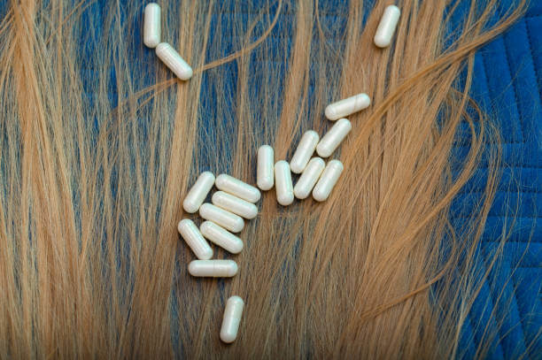 탈모 예방에 좋은 영양제 BEST 5 추천 💊