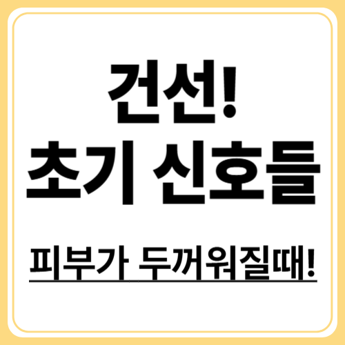 피부가 두꺼워진다? 건선 초기 증상 총정리