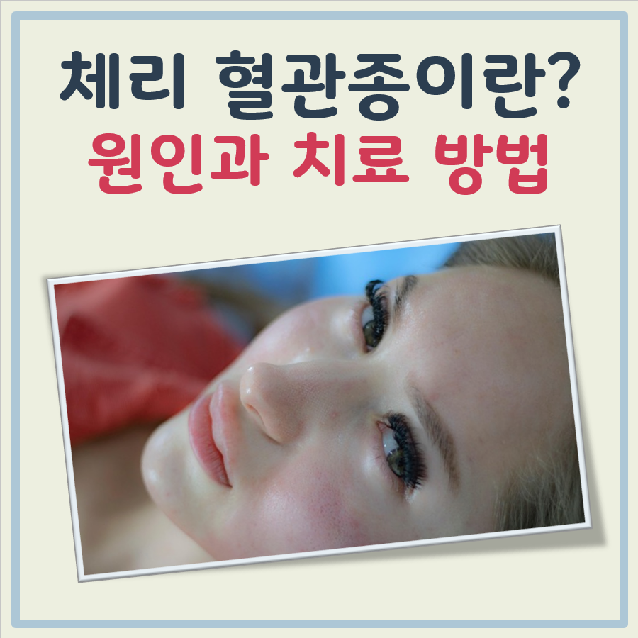 체리 혈관종 대표 이미지