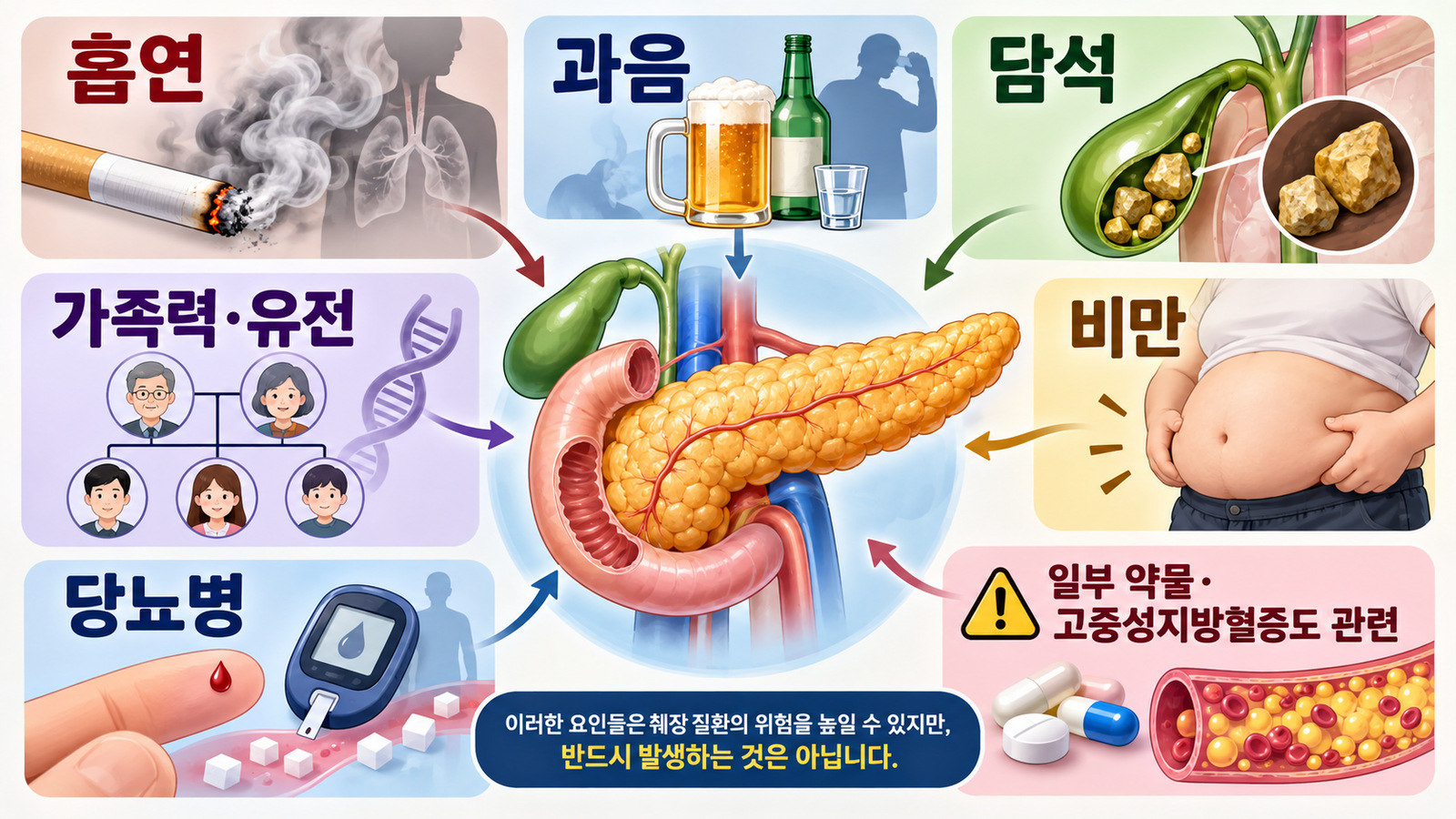 췌장 주변에 흡연, 과음, 담석, 가족력, 비만, 당뇨병과 일부 약물 및 고중성지방혈증을 구분해 표시한 의학 일러스트