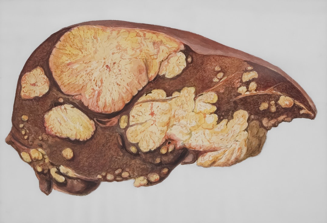 Colorectal cancer